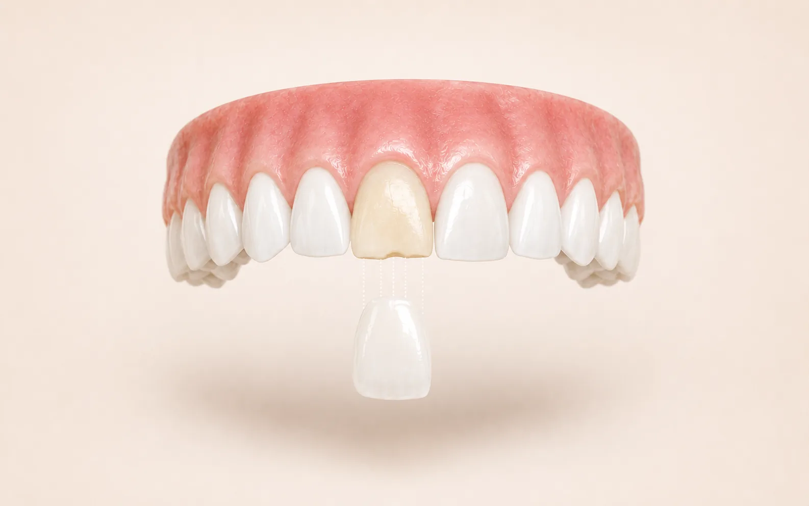 Estetica Dentara
